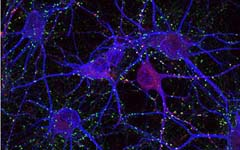 Synapses - image used with permission from Seth Grant, Wellcome Trust Sanger Institute