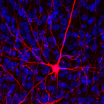 Synthetic DNA helps to visualize neurons in great detail. Photo courtesy of Andrew Kottick