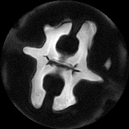 MRI of a walnut. Courtesy Tyler Meldrum.