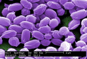 A scanning electron micrograph depicting spores of Anthrax. Source: Janice Haney Carr, CDC