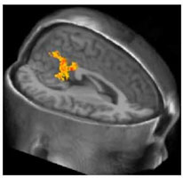 Neuroscience Symposium