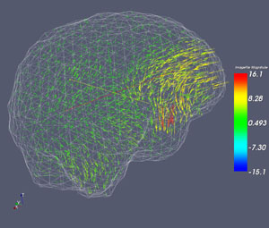 Tetrahedral mesh, shown as a wireframe, is the basis for the biomechanical model used to approximate overall brain deformation (shown by the colored arrows).