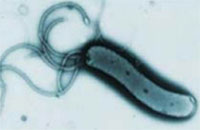 Helicobacter pylori is a bacterium that infects the human stomach