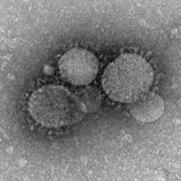 A MERS coronavirus shows its namesake crown-like structure under the microscope.