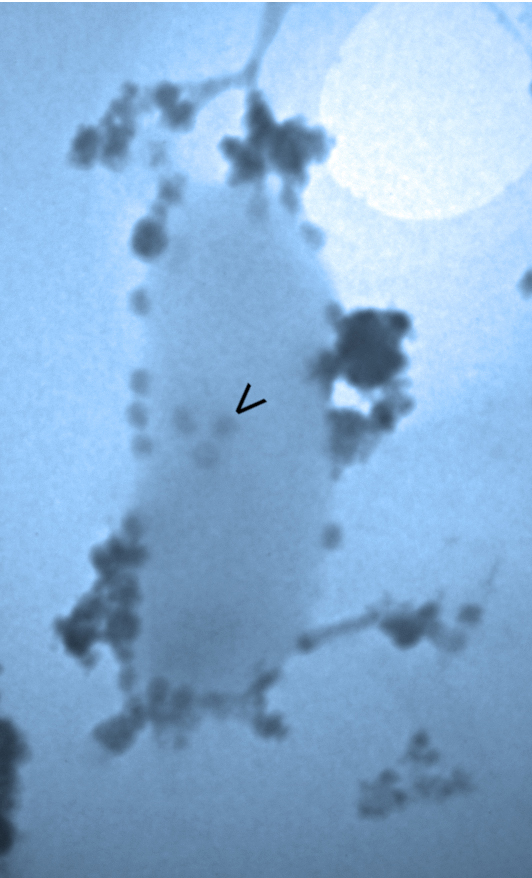 This image (at 30,000 X) is from the new eBay transmission electron microscope. The balloonish thing is a bacterium (perhaps Limnohabitans curvus) from Lake Matoaka. The little dots highlighted by the arrow are the heads of phage viruses assembling in the body of the bacterium. The phage heads are 50 nanometers across. (A human hair is around 40,000 nanometers in diameter.) Photo courtesy Kurt Williamson